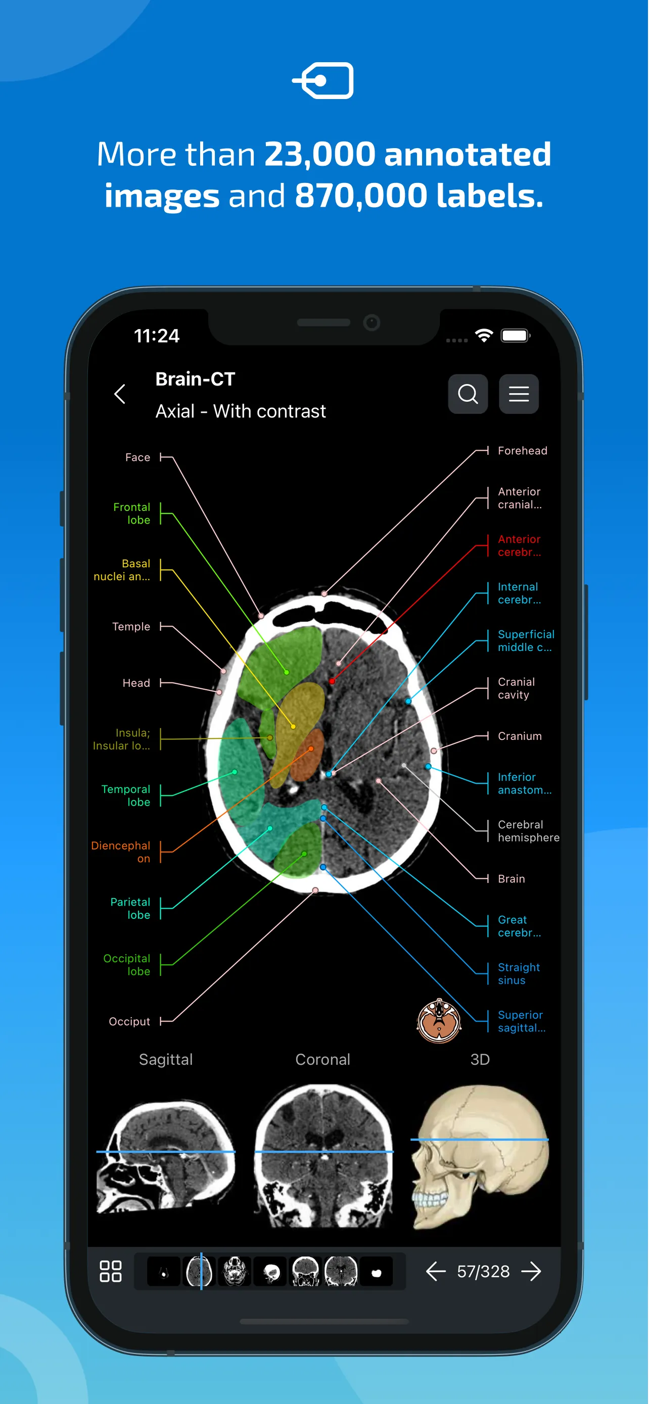 IMAIOS e-Anatomy iphone screenshot 2