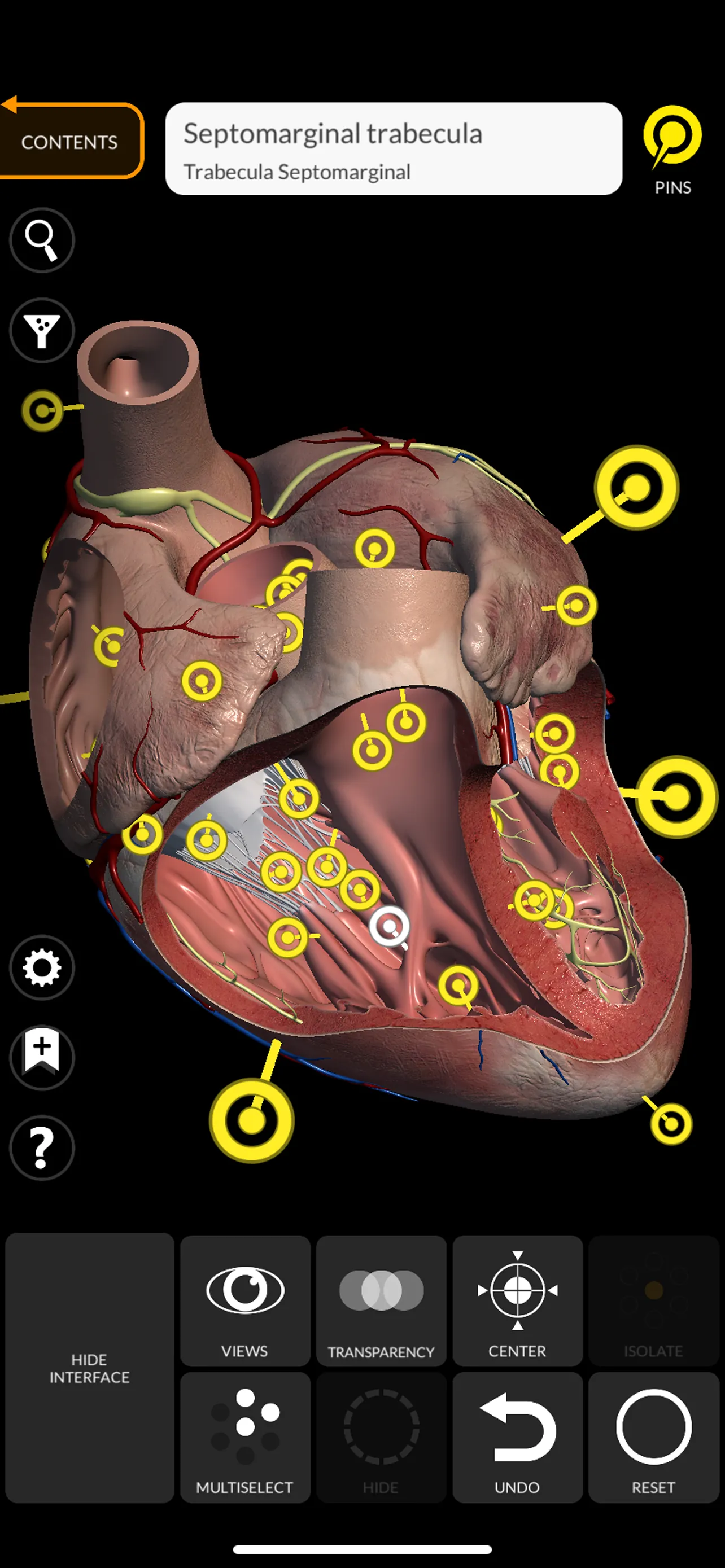 Anatomy 3D Atlas iphone screenshot 4