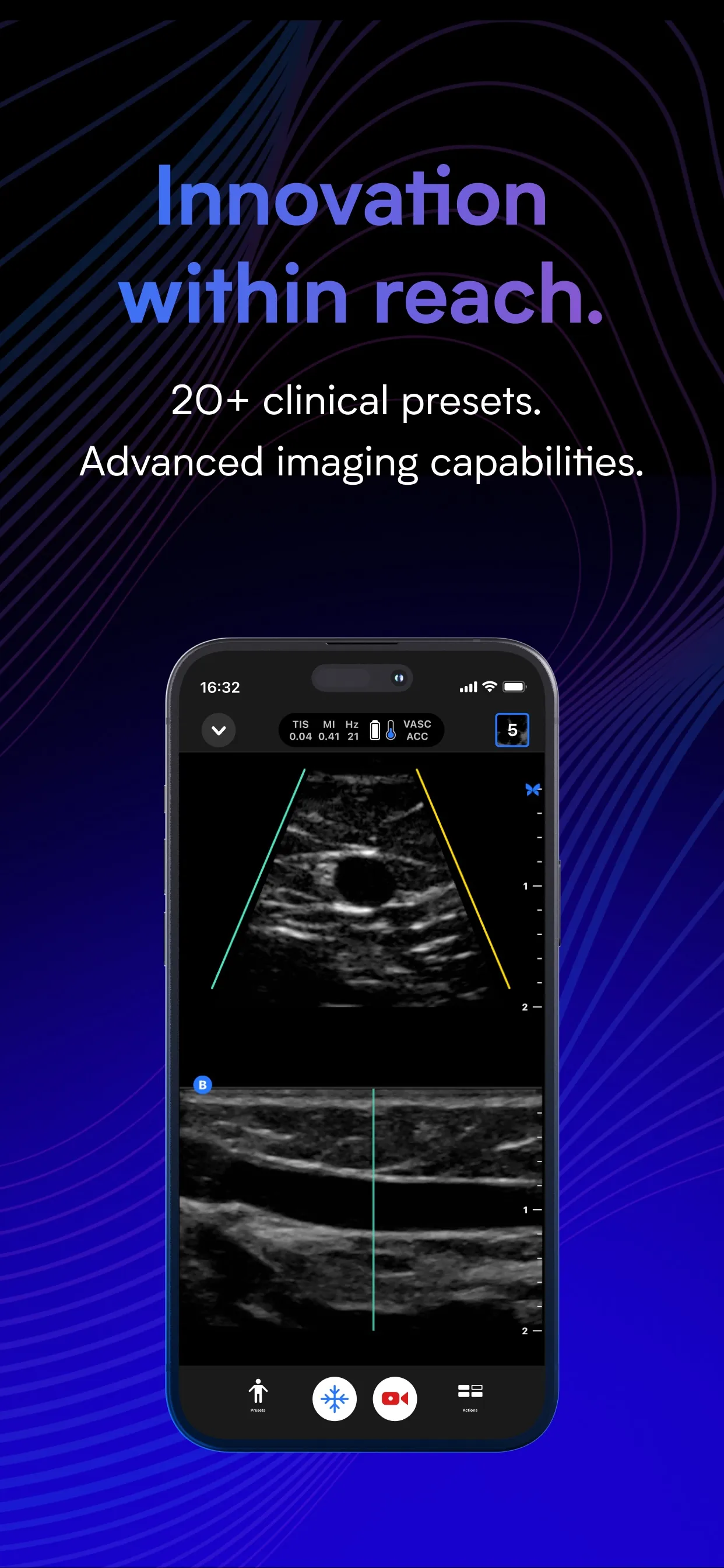 Butterfly iQ — Ultrasound iphone screenshot 2
