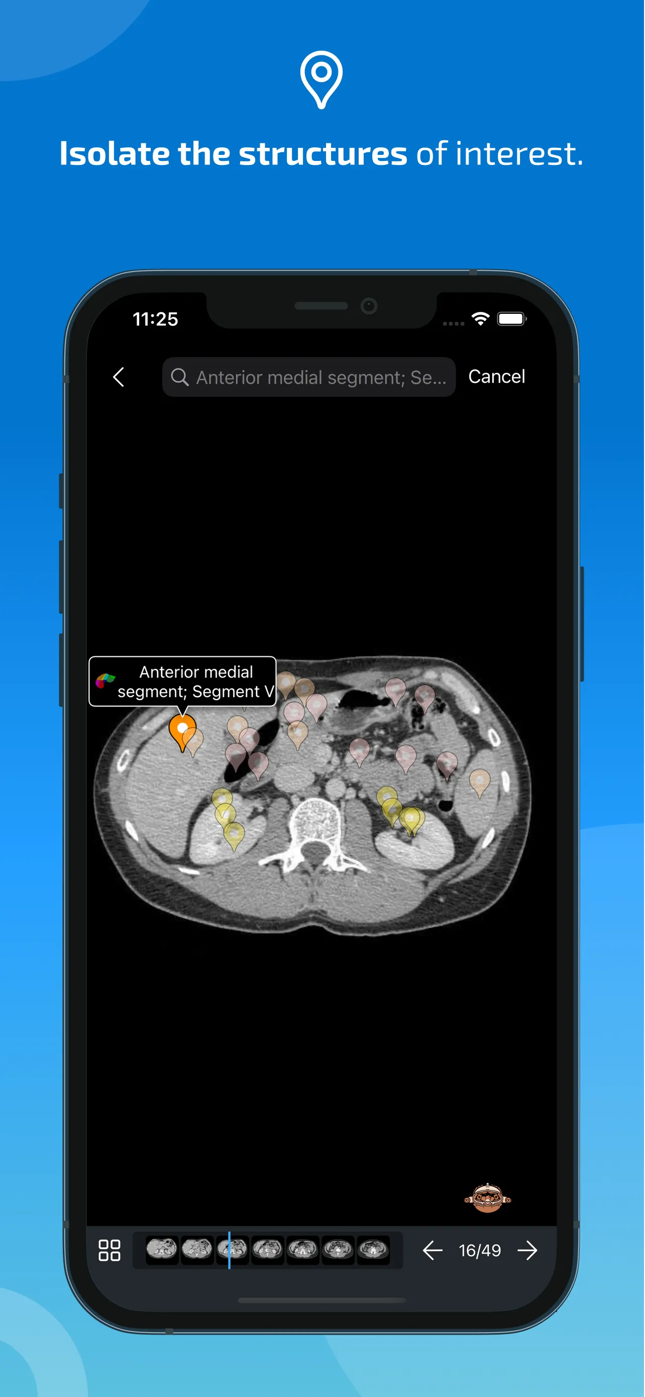 IMAIOS e-Anatomy iphone screenshot 4