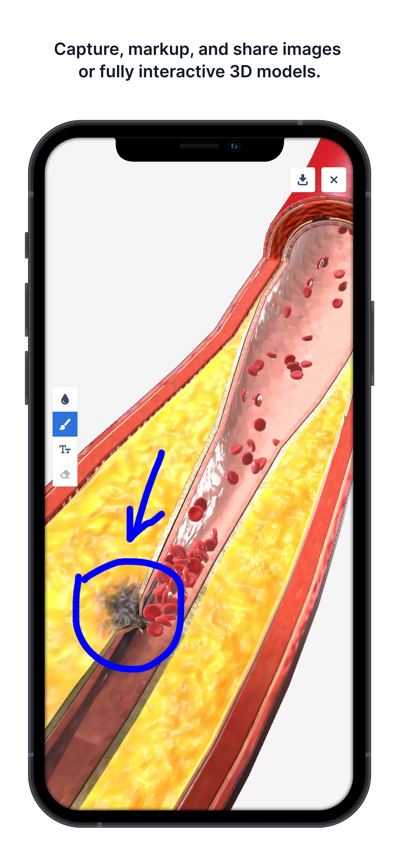 BioDigital - 3D Human Anatomy iphone screenshot 5