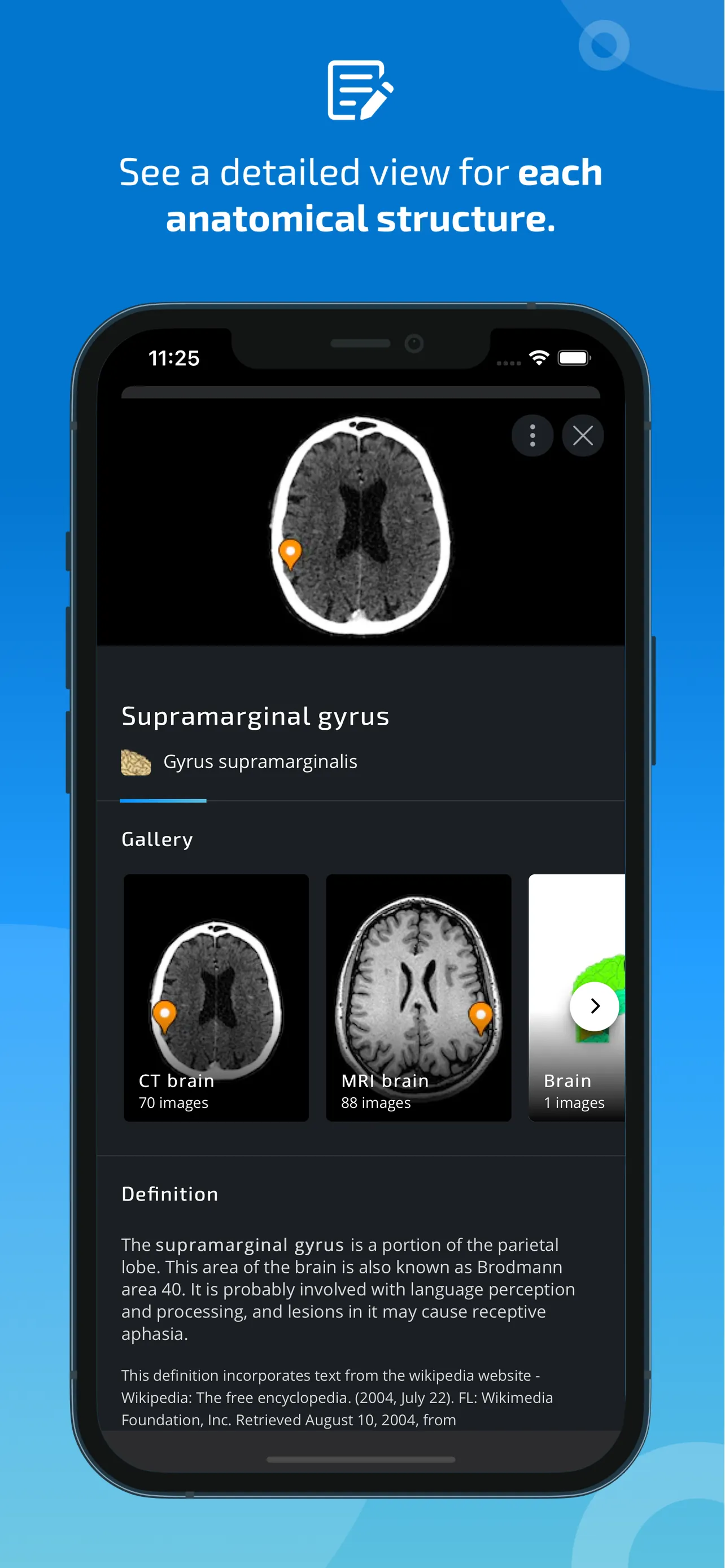 IMAIOS e-Anatomy iphone screenshot 5