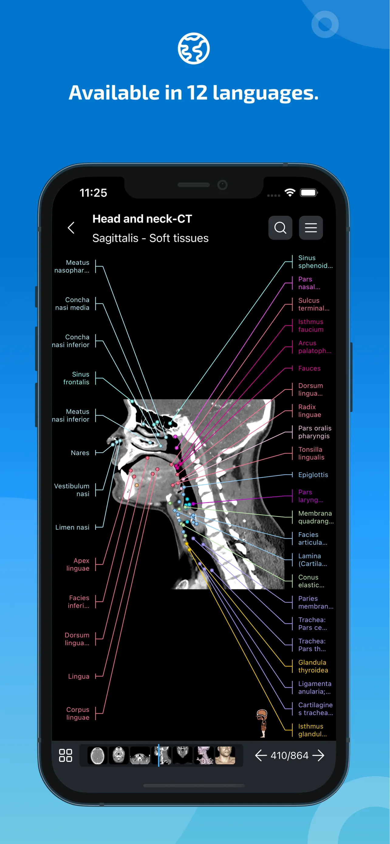 IMAIOS e-Anatomy iphone screenshot 7